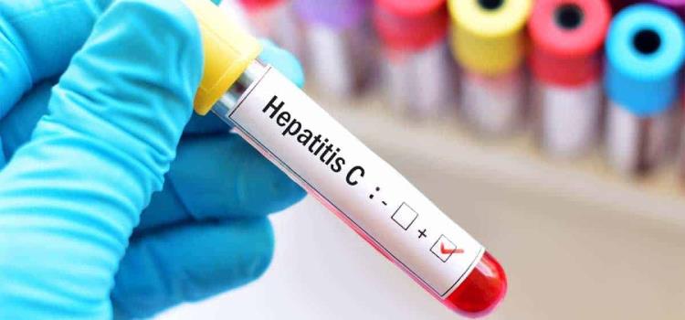 ALERTA POR HEPATITIS C